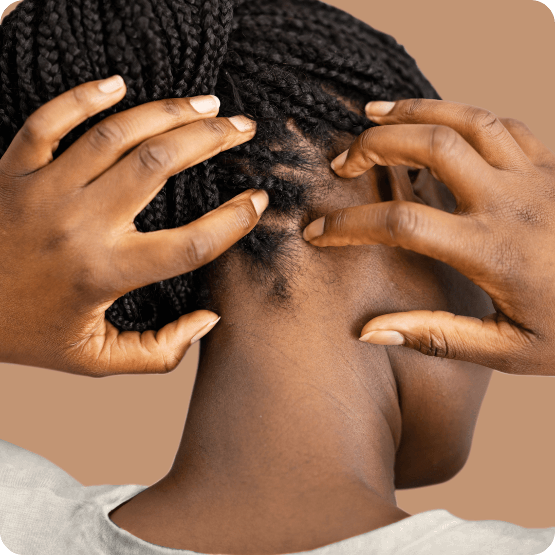 Sensitive Scalp